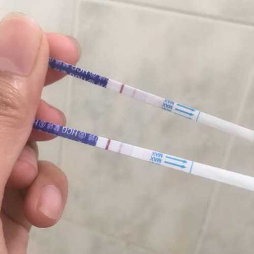 试管婴儿助孕费用详解与包生男孩服务